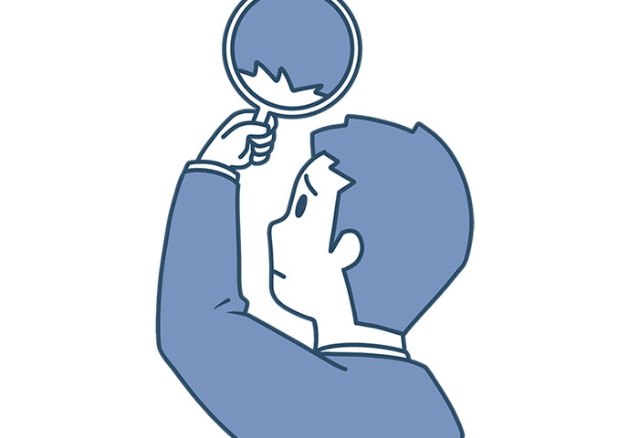 男性型脱毛症（AGA）イメージ