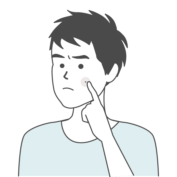 粉瘤イメージ