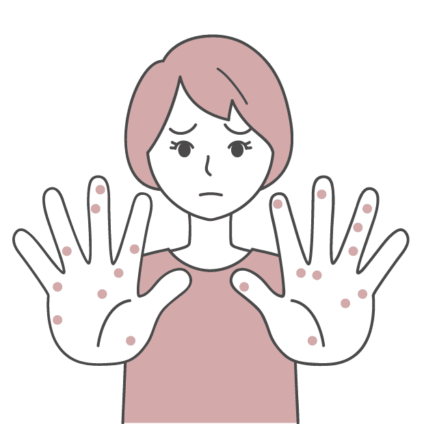 掌蹠膿疱症イメージ
