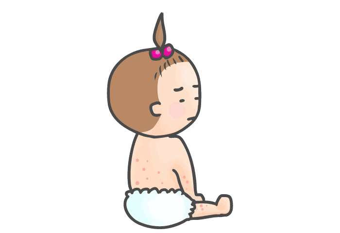 イボと水イボイメージ